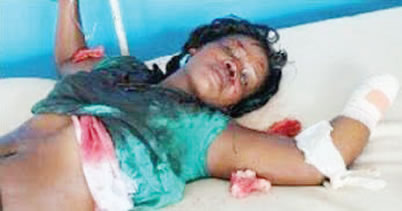 Husband cuts wife's hand over adultery suspicion