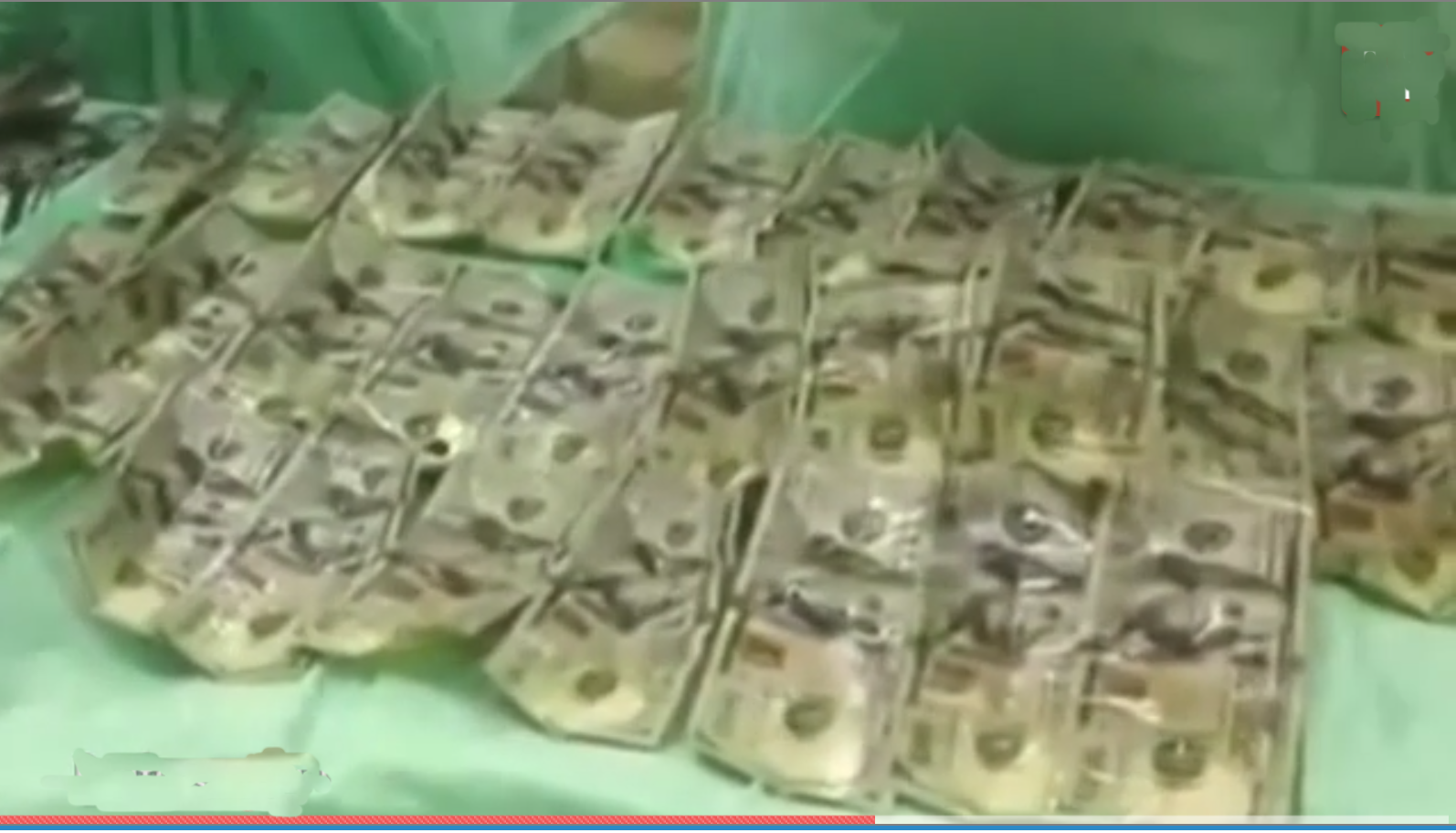 Money removed from woman's stomach
