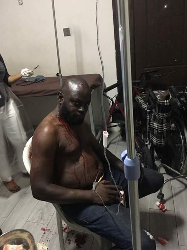 Odo Olowo APC Primary