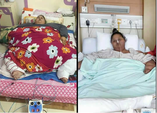 Worlds heaviest woman