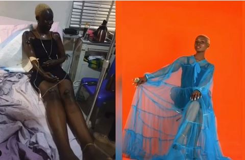 Nigerian Lady celebrates her birthday months after surviving gas explosion (photos)