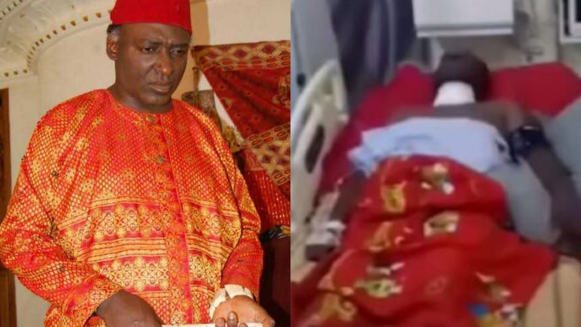 VIDEO: 'God has done it', actor Clems Ohameze speaks after surgery - WuzupNigeria